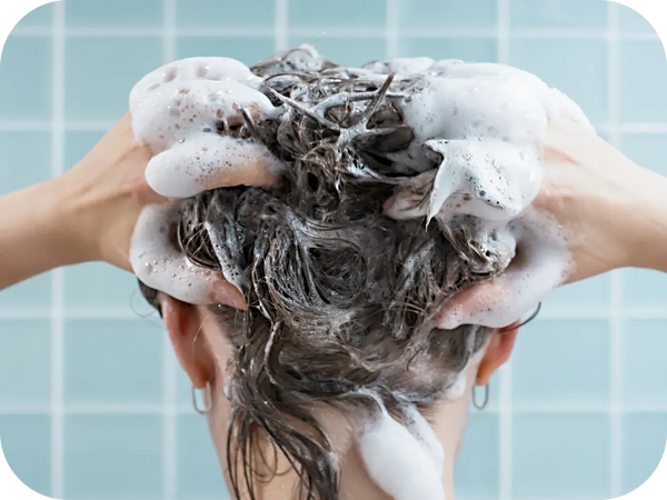 How Often Should You Wash Your Hair if You Have Seborrheic Dermatitis?
